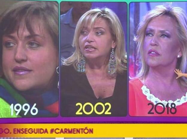 La evolución de piel de Lydia Lozano.